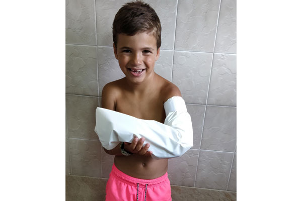 cubrescayolas infantil brazo entero cubrescayolas infantil brazo entero